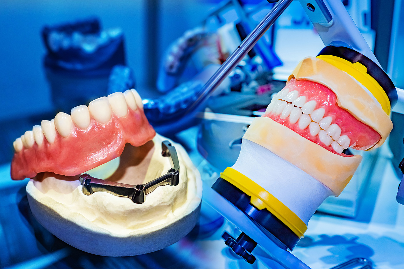 Custom dentures, Kary Dental