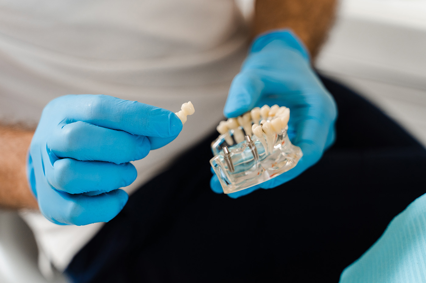 Dental implants, Kary Dental