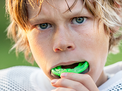 Sports mouthguards, Kary Dental